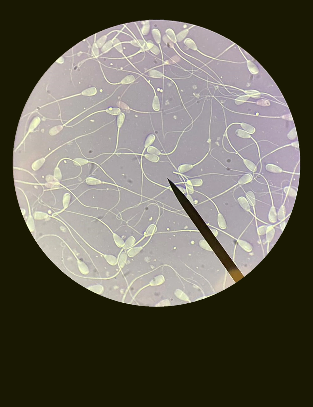 Une image de spermatozoides au microscope